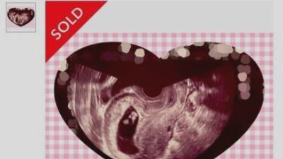 “태아 초음파 사진 5만6000원” 日중고거래에 발칵